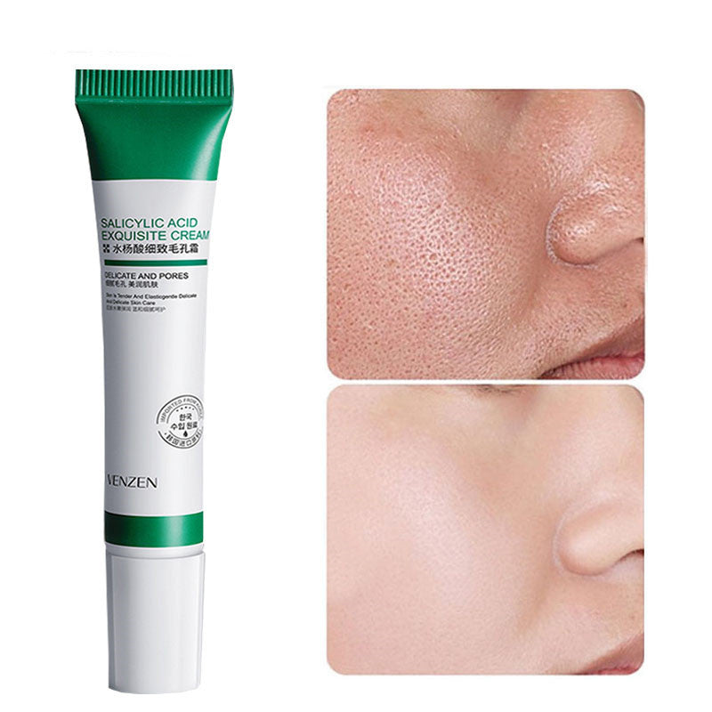 Nahaufnahme der Salicylic Acid Exquisite Cream Tube: Produktabbildung der Tube mit grünem Deckel und weißer Beschriftung.